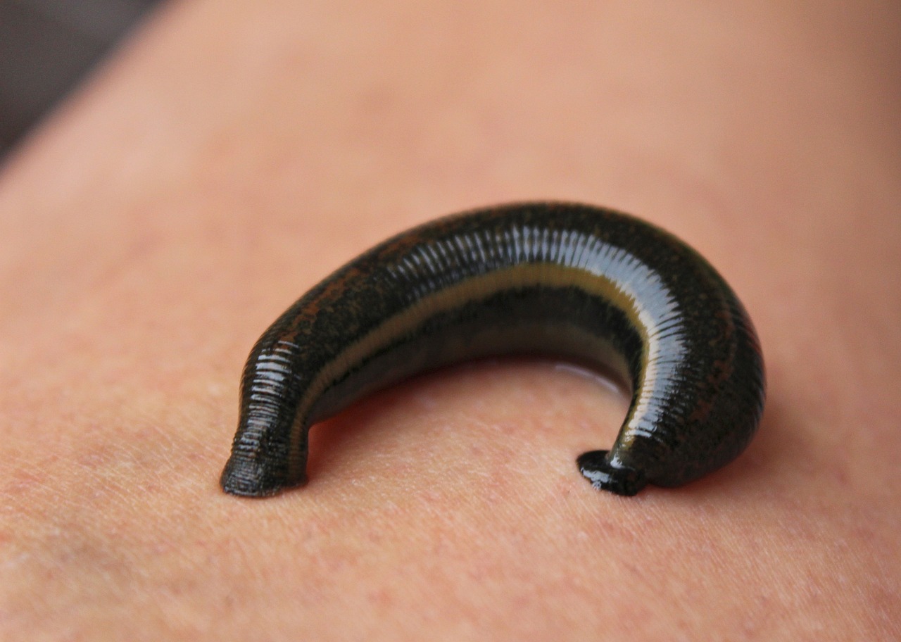 pijavice a hirudoterapia